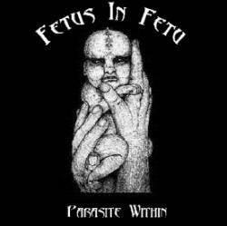 Fetus In Fetu : Parasite Within